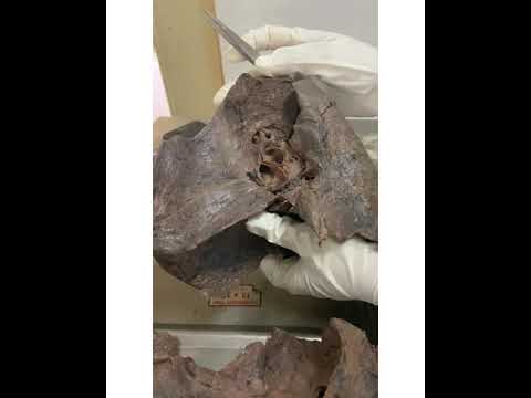 demo lung part
