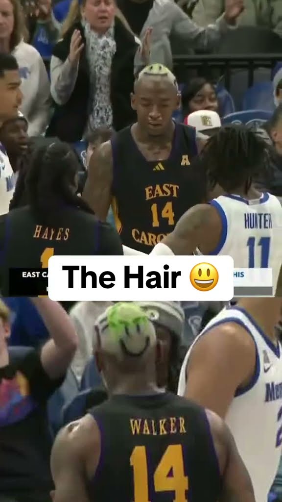 The hair ?