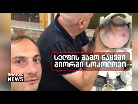 ცემა სელფის გამო - გიორგი სოკოლოვი ოზურგეთის ყოფილ მერს ფიზიკურ ძალადობაში ადანაშაულებს