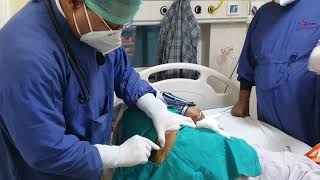 Bone Marrow Aspiration and Biopsy Dr Sandeep Kumar garg Nutema Hospital screenshot 3