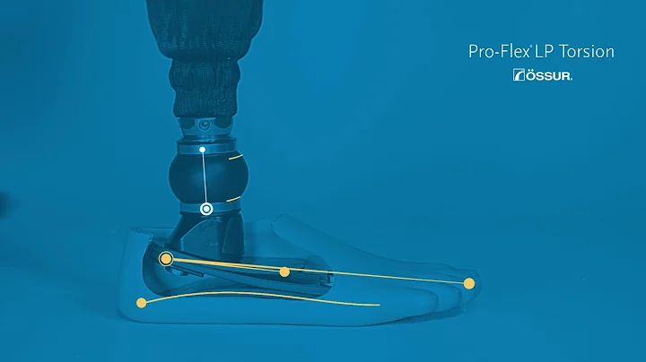 ProFlex LP Torsion Technology