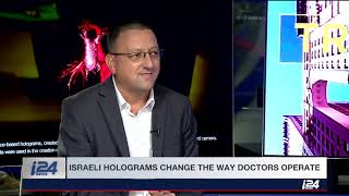 Realview Imaging, Breakthrough 3D Medical Holographic Technology, Featured On I24 News