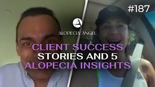 Natural Alopecia Healing & Success Stories + 5 Things I Took for Granted After Alopecia Ep 187