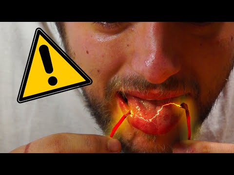 Video: Lesioni Da Shock Elettrico Nei Gatti