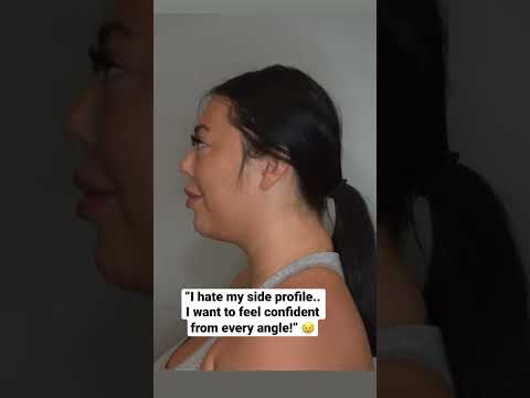 Video: Jak snížit obličejový tuk: 14 kroků (s obrázky)