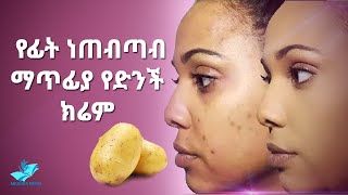 Ethiopia:- በ7 ቀን በድንች ፊታችንን ማጥሪያ ቀላል ዘዴ | Removing Dark Spots In 7 Days 100% Natural