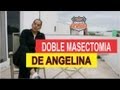 DOBLE MASTECTOMIA DE ANGELINA