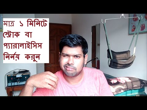 ভিডিও: অপমানজনক মাথা ট্রমা জন্য সবচেয়ে সাধারণ ট্রিগার কি?