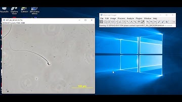 How to subtract image background with ImageJ-Fiji