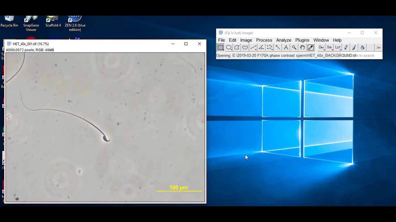 Analyzing Fluorescence Microscopy Images With Imagej