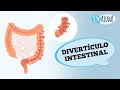 DOENÇA DIVERTICULAR E DIVERTICULITE: SINTOMAS, DIAGNÓSTICO E TRATAMENTO