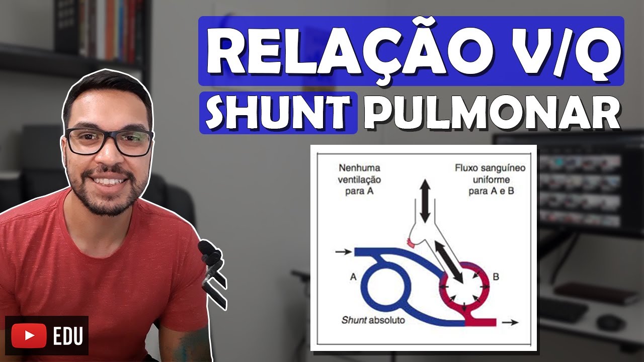 Cartões: Relação Ventilação-perfusão - Anet-Review