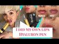 HYALURON PEN, I DID MY OWN LIPS, WOW!! Tutorial and Result