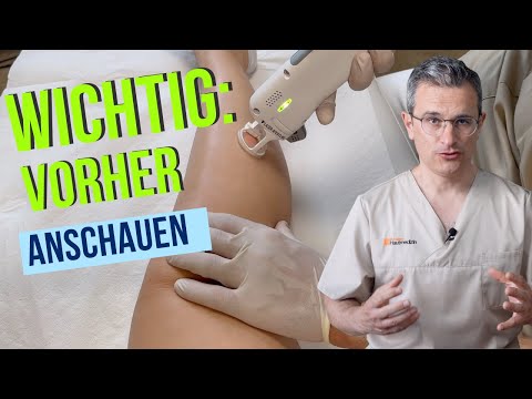 Haarentfernung mit Laser oder IPL: Ablauf, Erfolge, Risiken und Tipps von Dr. Robert Kasten, Mainz