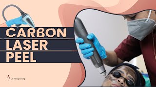 Carbon Laser Peel Treatment for Glowing Skin | Laser Treatment | Plastic Surgery in Mumbai