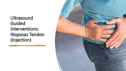 #ultrasound Guided Interventions: Iliopsoas (Injection) #fyp #sport #sports #sportsmedicine