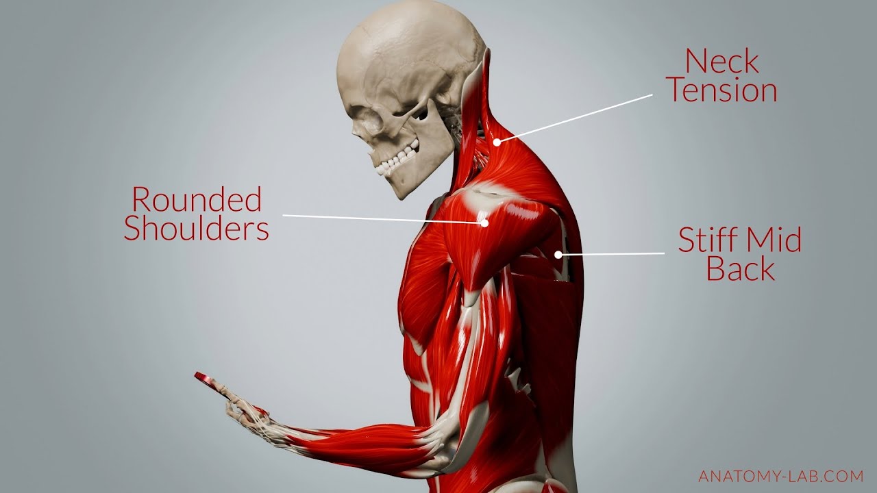 How Your Phone Is Changing Your Posture - YouTube