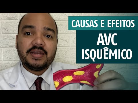 Vídeo: O AVC isquêmico tem cura?