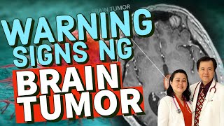Warning Signs ng Brain Tumor - Payo ni Dr Epi Collantes (Neurologist) at Doc Willie Ong