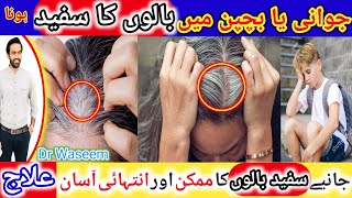 Safed Balon ka Ilaj- premature Grey Hair-white Baal Kale Kaise Karen-Who To Prevent White Hair