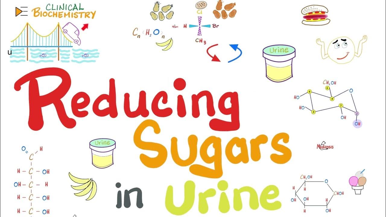 why-is-there-sugar-in-my-urine-glucosuria-fructosuria-reducing