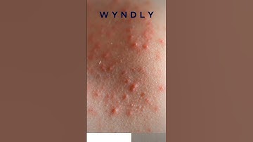 What Causes Red Spots On The Skin?