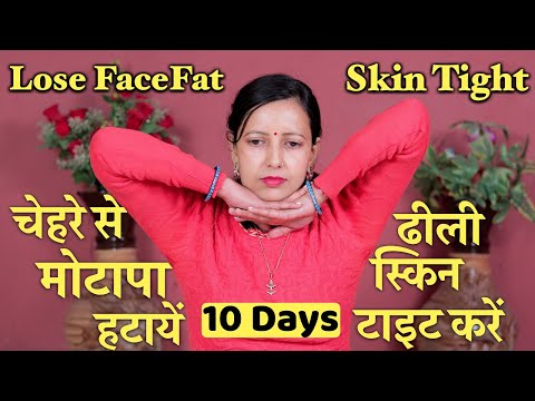 How to Lose Face Fat, Sagging Skin | Skin Tightening | चेहरे से मोटापा हटाएँ 10 दिनों में