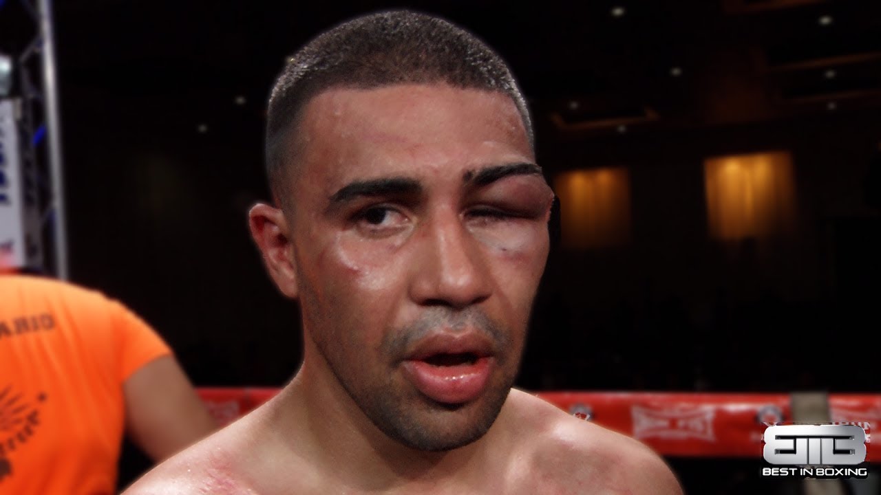 Great Fight! Best In Boxing: Roberto Meza vs Omar Aguilar