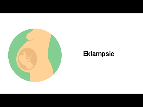 Video: Eklampsie Der Schwangerschaft Und Nach Der Geburt - Behandlung, Symptome