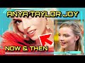 Anya Taylor Joy teeth then and now: before and after surgery tooth transformation Hollywood veneers