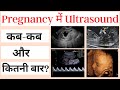 Pregnancy में अल्ट्रसाउंड कब और कितनी बार करना चाहिए | Sonography In Pregnancy