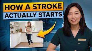What a Stroke Looks Like the Day Before It Hits — Know This to Protect Yourself