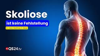 Scoliosis Is Not a Deformity – What’s Really Behind It | Natural Medicine | QS24