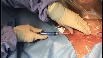 LANDMARK-guided Subclavian Central Line Insertion (in real-time)