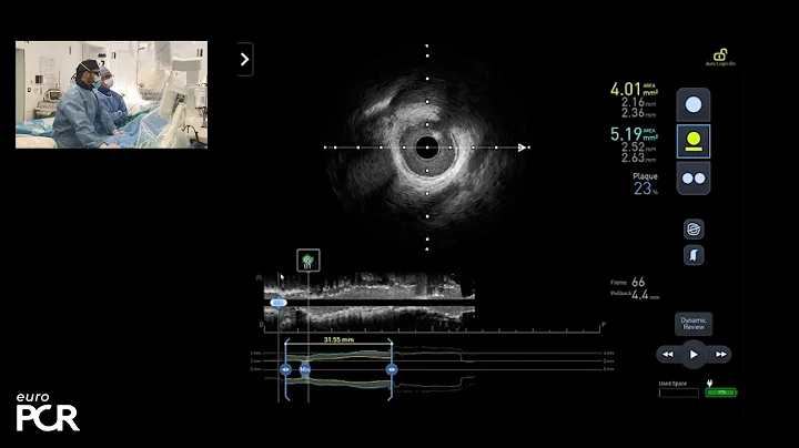How to make complex PCI safe, simple, effective with new angiography imaging guidance - EuroPCR 2024