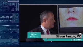 Confused About Botox vs Fillers? Here’s the Difference (2015) screenshot 2