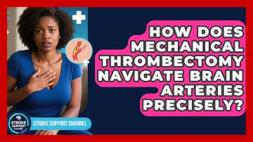 How Does Mechanical Thrombectomy Navigate Brain Arteries Precisely? - Stroke Support Channel