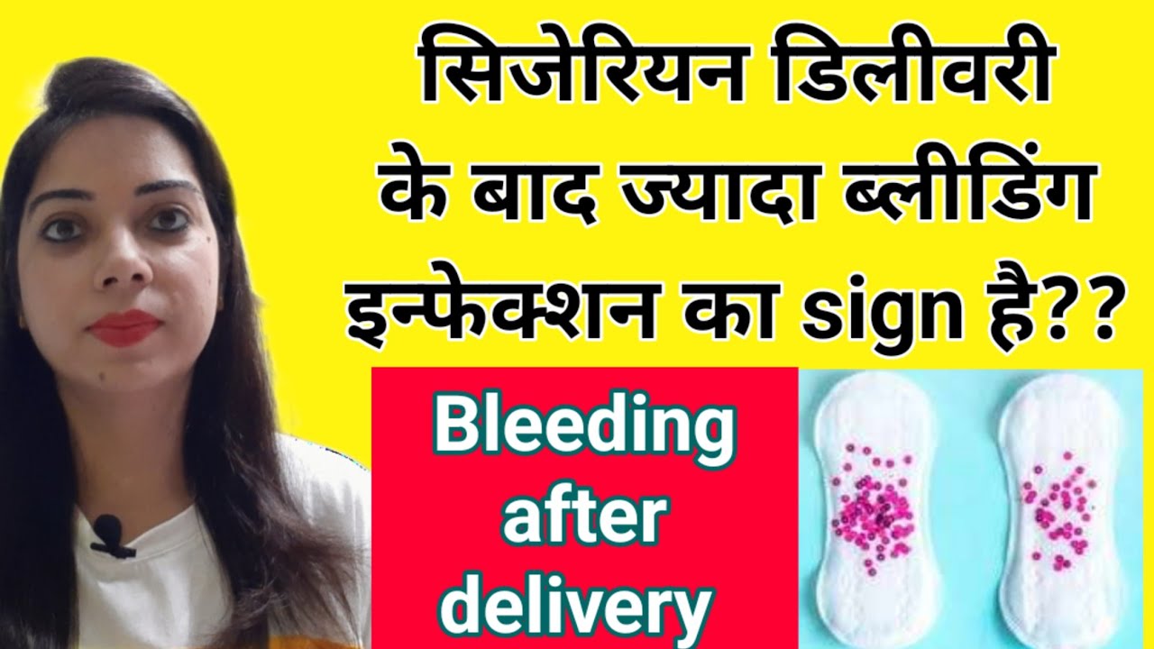 डिलीवरी के बाद कितनी bleeding या discharge होना नॉर्मल हैBleeding