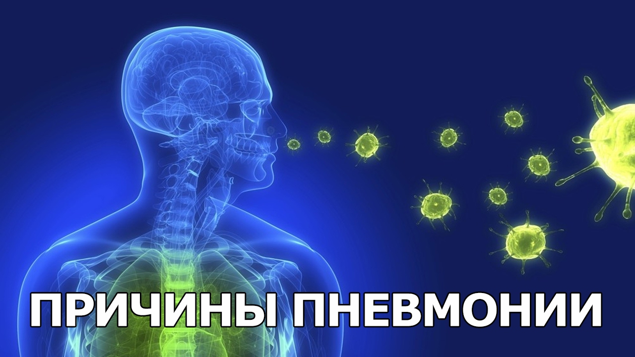 Причины пневмонии