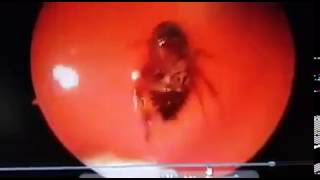 видео К чему снятся живые тараканы?
