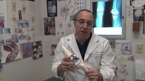 Rotating Platform Total Knee