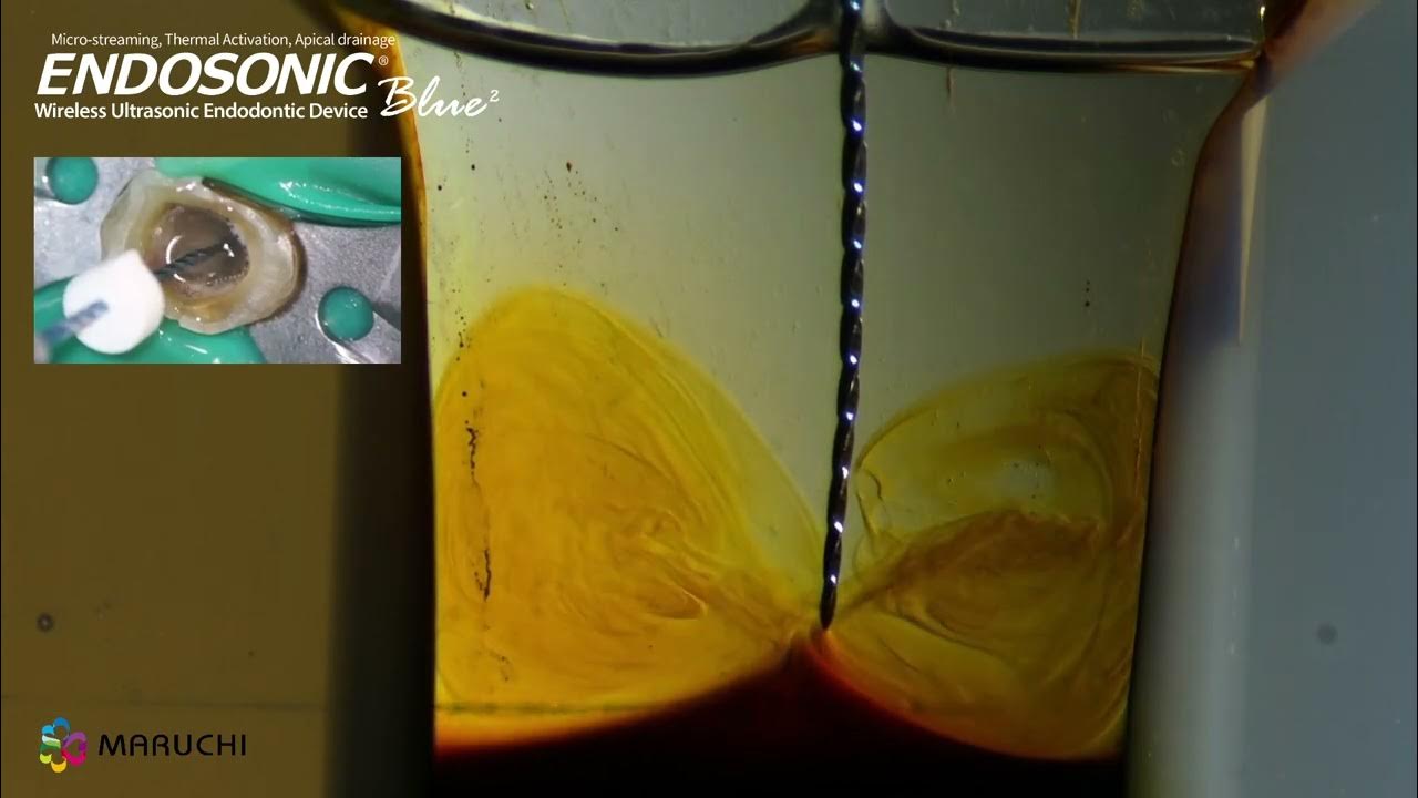 Endosonic Blue2 Apical Drainage & Negative pressure YouTube