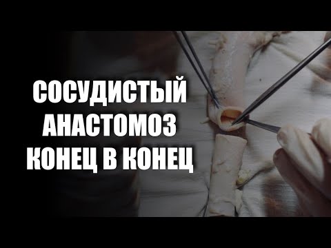 Видео: Почему важны сосудистые анастомозы?