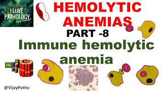 Hemolytic Anemias- Part 8: Immune Hemolytic Anemia (IHA)