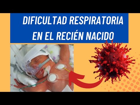 Vídeo: Síndrome De Dificultad Respiratoria Neonatal