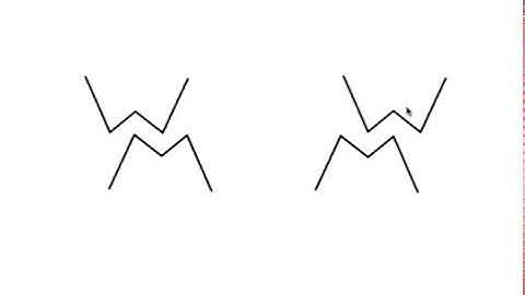 Selective Equilibration of Denture Teeth