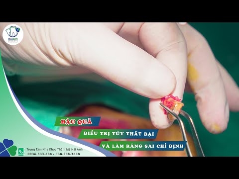 Video: Điều Trị Thất Bại Và Thất Bại điều Trị