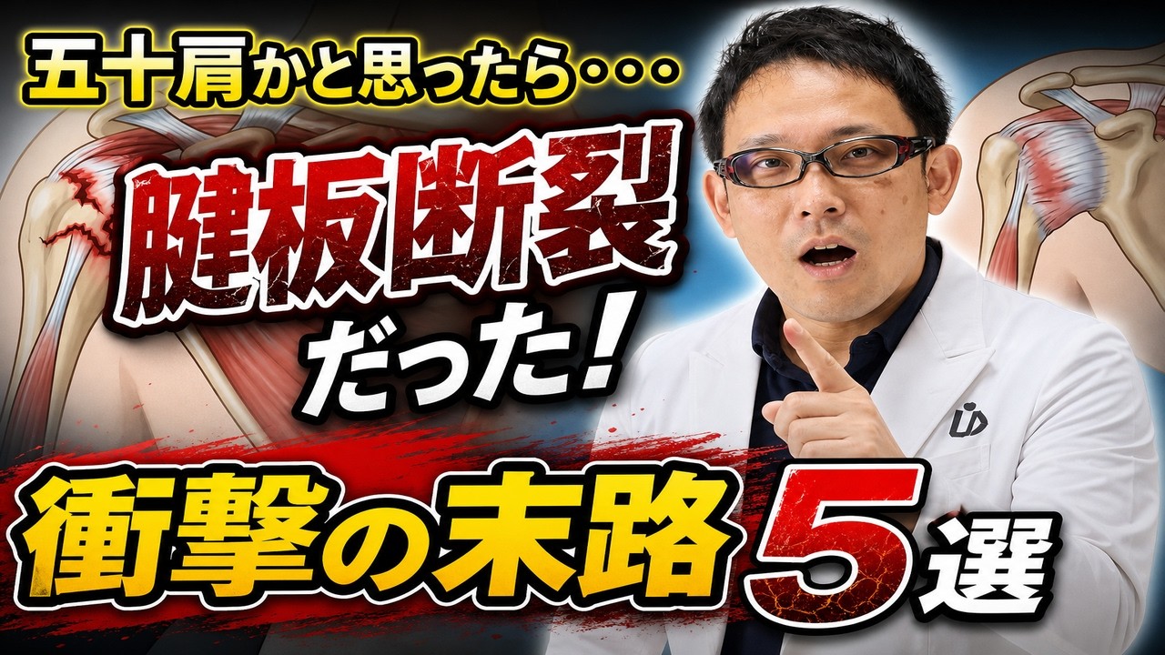 【五十肩と腱板断裂の見分け方】腕が上がっても危険？放置NGな見逃しサイン5選を整形外科医が徹底解説！