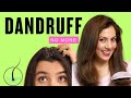 How to get rid of dandruff at home | How to remove dandruff | best anti dandruff shampoo
