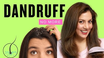 How to get rid of dandruff at home | How to remove dandruff | best anti dandruff shampoo 